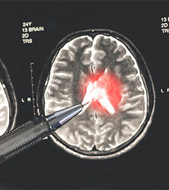 Neurology
